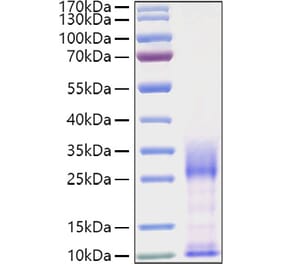 SDS-PAGE - Recombinant Mouse IL-3 Protein (C-terminal His Tag) (A330883) - Antibodies.com