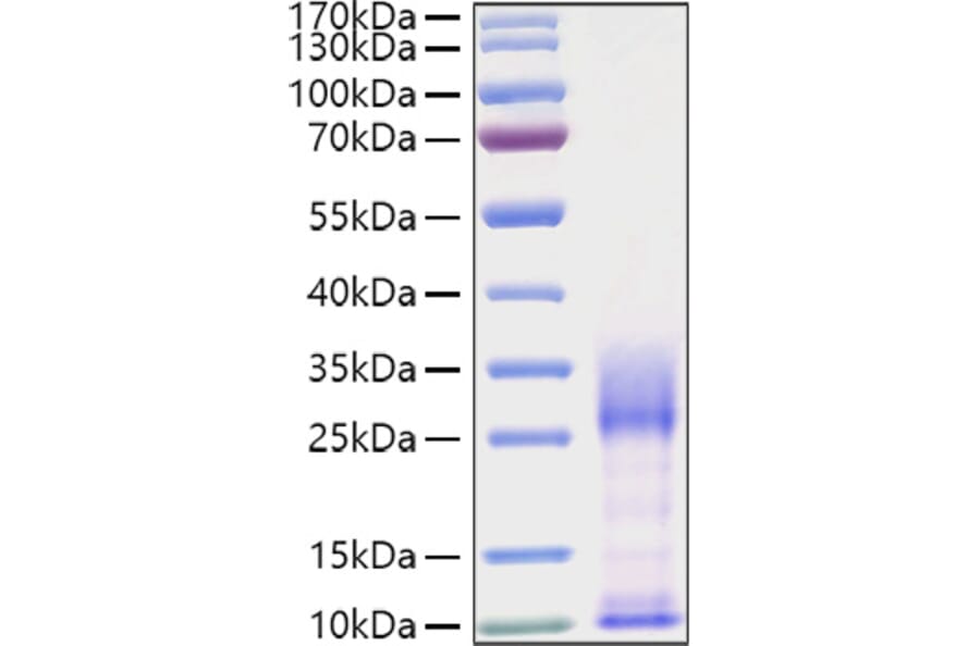 SDS-PAGE - Recombinant Mouse IL-3 Protein (C-terminal His Tag) (A330883) - Antibodies.com