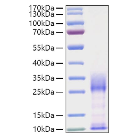 SDS-PAGE - Recombinant Mouse IL-3 Protein (C-terminal His Tag) (A330883) - Antibodies.com