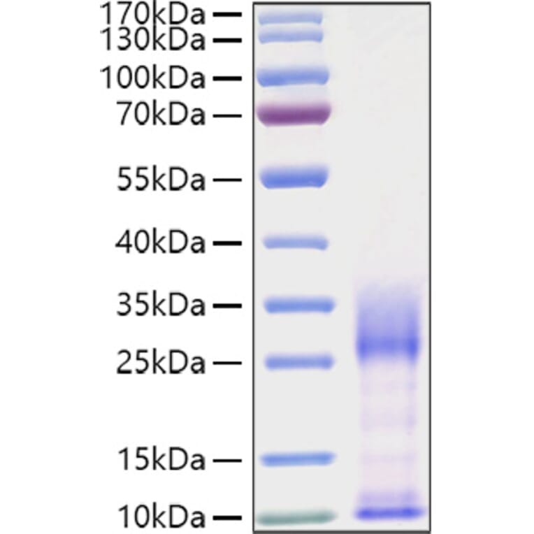 SDS-PAGE - Recombinant Mouse IL-3 Protein (C-terminal His Tag) (A330883) - Antibodies.com