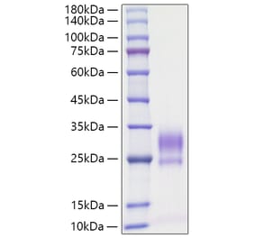 SDS-PAGE - Recombinant Rat IL-3 Protein (C-terminal His Tag) (A330884) - Antibodies.com