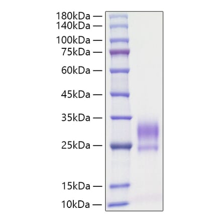 SDS-PAGE - Recombinant Rat IL-3 Protein (C-terminal His Tag) (A330884) - Antibodies.com