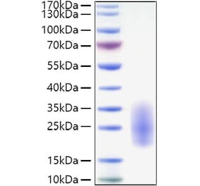 SDS-PAGE - Recombinant Human IL-3 Protein (C-terminal His Tag) (A330885) - Antibodies.com