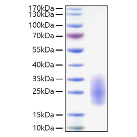 SDS-PAGE - Recombinant Human IL-3 Protein (C-terminal His Tag) (A330885) - Antibodies.com