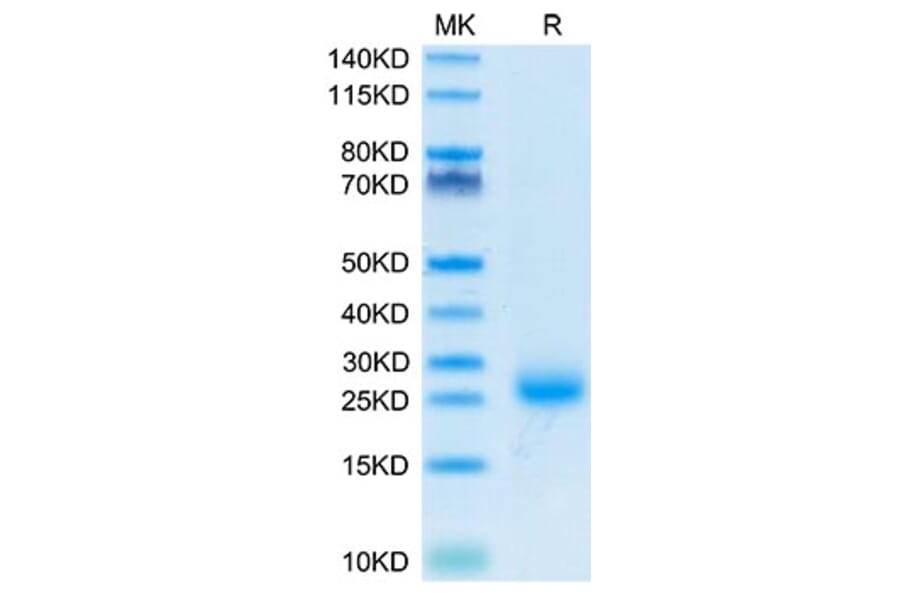 Tris-Bis PAGE - Recombinant Cynomolgus macaque IL-31 Protein (N-terminal His Tag) (A330886) - Antibodies.com