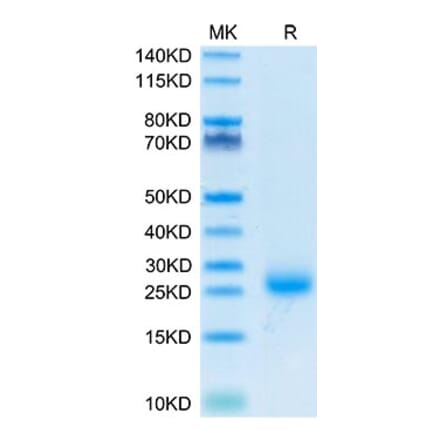 Tris-Bis PAGE - Recombinant Cynomolgus macaque IL-31 Protein (N-terminal His Tag) (A330886) - Antibodies.com