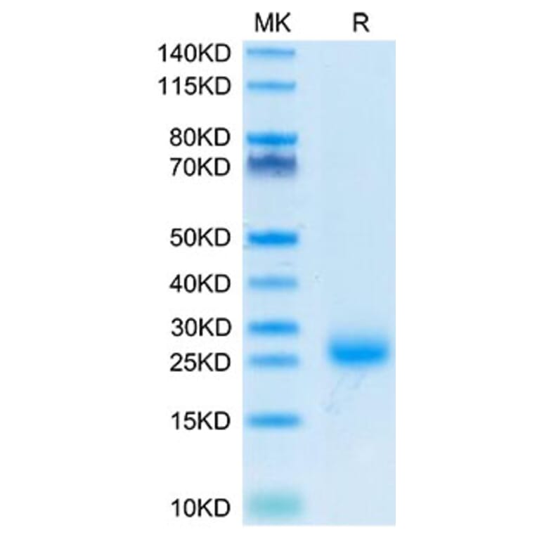 Tris-Bis PAGE - Recombinant Cynomolgus macaque IL-31 Protein (N-terminal His Tag) (A330886) - Antibodies.com