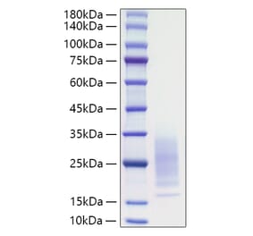 SDS-PAGE - Recombinant Mouse IL-31 Protein (C-terminal His Tag) (A330887) - Antibodies.com