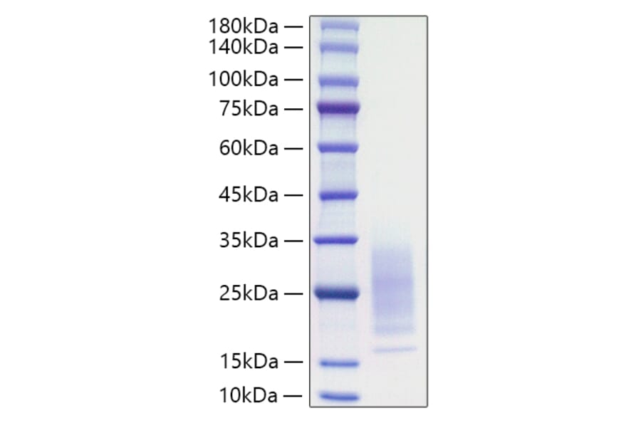 SDS-PAGE - Recombinant Mouse IL-31 Protein (C-terminal His Tag) (A330887) - Antibodies.com