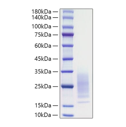 SDS-PAGE - Recombinant Mouse IL-31 Protein (C-terminal His Tag) (A330887) - Antibodies.com