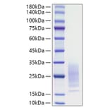 SDS-PAGE - Recombinant Mouse IL-31 Protein (C-terminal His Tag) (A330887) - Antibodies.com