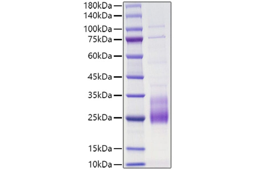 SDS-PAGE - Recombinant Human IL-31 Protein (N-terminal His Tag) (A330888) - Antibodies.com
