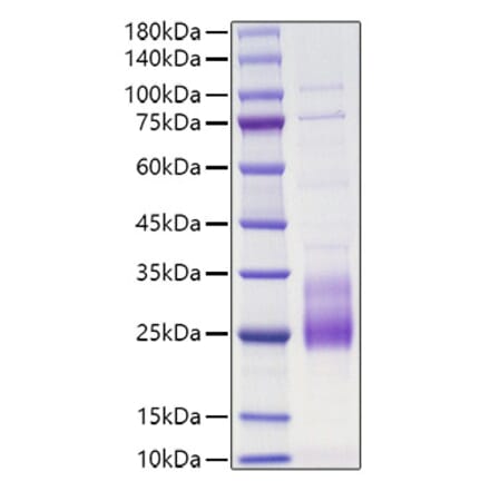 SDS-PAGE - Recombinant Human IL-31 Protein (N-terminal His Tag) (A330888) - Antibodies.com