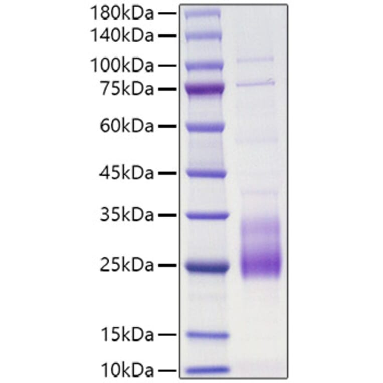 SDS-PAGE - Recombinant Human IL-31 Protein (N-terminal His Tag) (A330888) - Antibodies.com