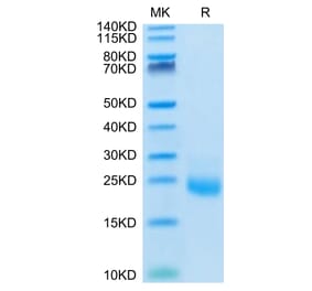Tris-Bis PAGE - Recombinant Human IL-31 Protein (N-terminal His Tag) (A330889) - Antibodies.com