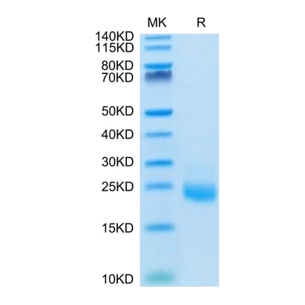 Tris-Bis PAGE - Recombinant Human IL-31 Protein (N-terminal His Tag) (A330889) - Antibodies.com