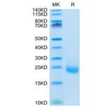 Tris-Bis PAGE - Recombinant Human IL-31 Protein (N-terminal His Tag) (A330889) - Antibodies.com