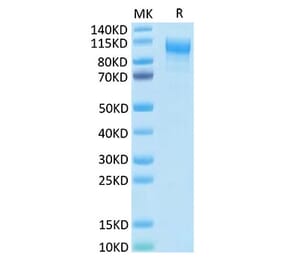 Tris-Bis PAGE - Recombinant Human IL-31RA Protein (C-terminal His Tag) (A330890) - Antibodies.com