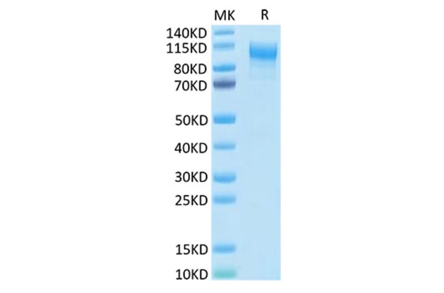 Tris-Bis PAGE - Recombinant Human IL-31RA Protein (C-terminal His Tag) (A330890) - Antibodies.com