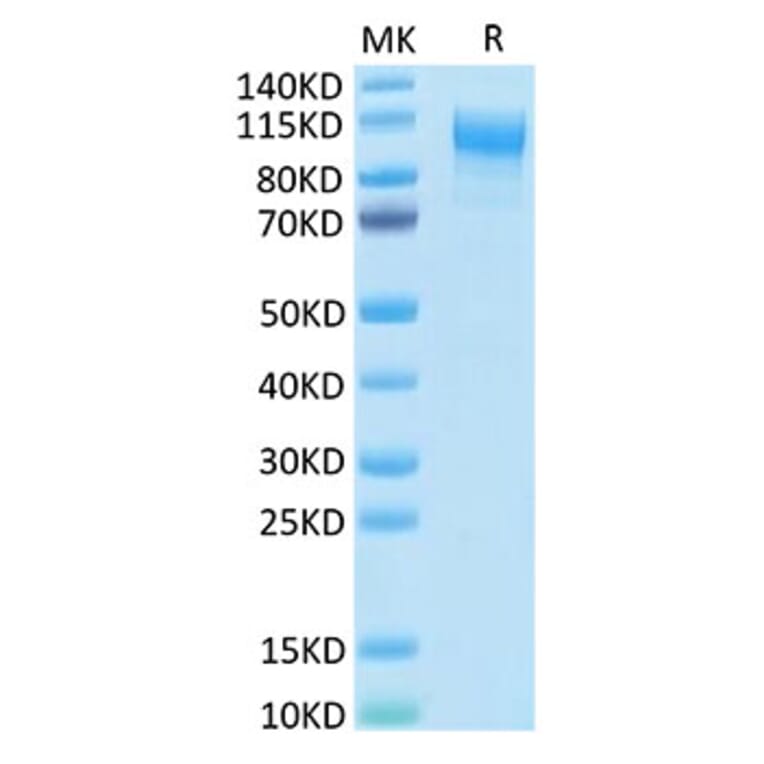 Tris-Bis PAGE - Recombinant Human IL-31RA Protein (C-terminal His Tag) (A330890) - Antibodies.com