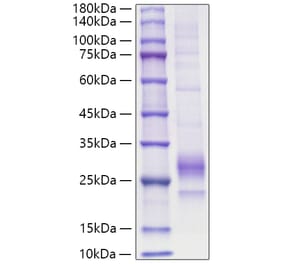 SDS-PAGE - Recombinant Mouse IL-33 Protein (C-terminal His Tag) (A330892) - Antibodies.com
