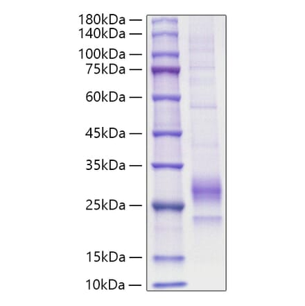 SDS-PAGE - Recombinant Mouse IL-33 Protein (C-terminal His Tag) (A330892) - Antibodies.com