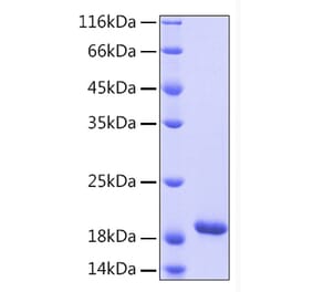 SDS-PAGE - Recombinant Human IL-33 Protein (A330893) - Antibodies.com