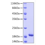 SDS-PAGE - Recombinant Human IL-33 Protein (A330893) - Antibodies.com