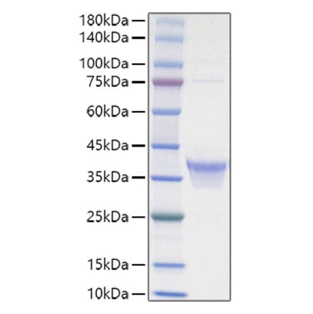 SDS-PAGE - Recombinant human IL-34 Protein (C-terminal His Tag) (A330894) - Antibodies.com