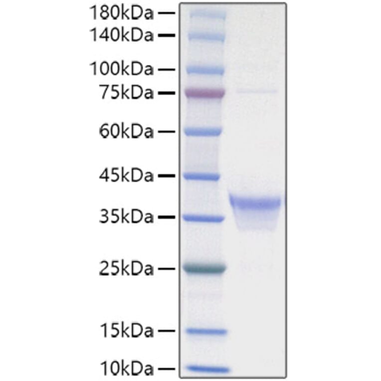 SDS-PAGE - Recombinant human IL-34 Protein (C-terminal His Tag) (A330894) - Antibodies.com