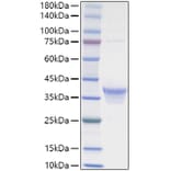 SDS-PAGE - Recombinant human IL-34 Protein (C-terminal His Tag) (A330894) - Antibodies.com