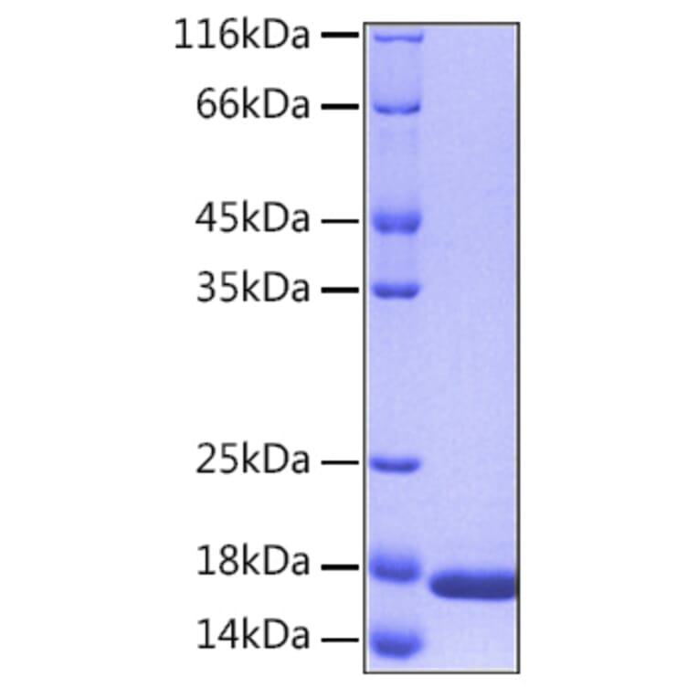 SDS-PAGE - Recombinant Human IL36 alpha/IL-1F6 Protein (C-terminal His Tag) (A330896) - Antibodies.com