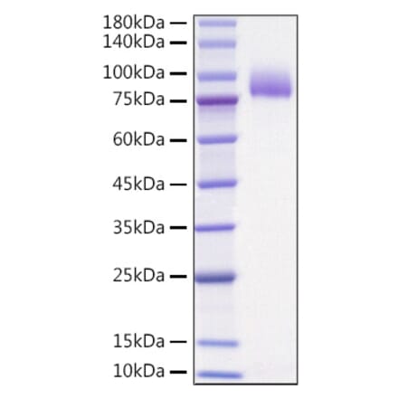 SDS-PAGE - Recombinant Human IL-36R Protein (C-terminal Human Fc Tag) (A330899) - Antibodies.com