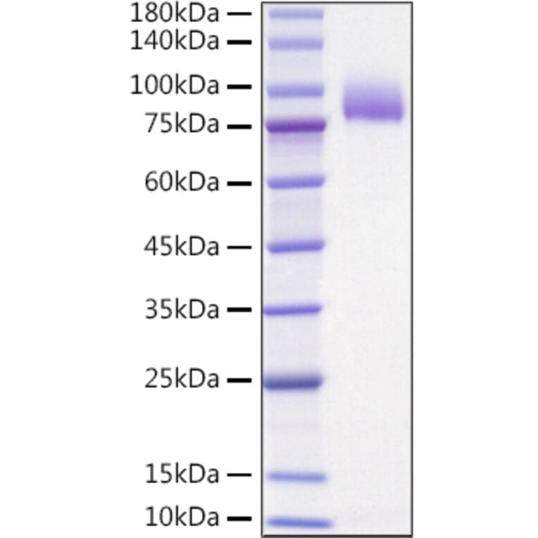 SDS-PAGE - Recombinant Human IL-36R Protein (C-terminal Human Fc Tag) (A330899) - Antibodies.com