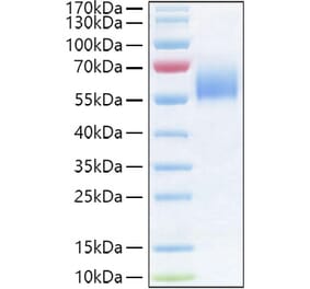 SDS-PAGE - Recombinant Human IL-36R Protein (C-terminal His Tag) (A330900) - Antibodies.com