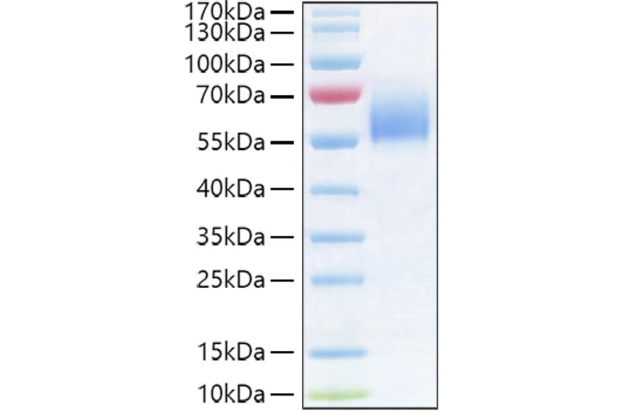 SDS-PAGE - Recombinant Human IL-36R Protein (C-terminal His Tag) (A330900) - Antibodies.com