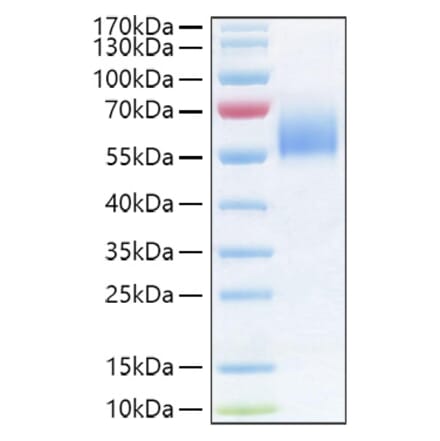 SDS-PAGE - Recombinant Human IL-36R Protein (C-terminal His Tag) (A330900) - Antibodies.com