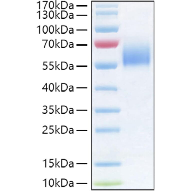 SDS-PAGE - Recombinant Human IL-36R Protein (C-terminal His Tag) (A330900) - Antibodies.com