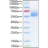 SDS-PAGE - Recombinant Human IL-36R Protein (C-terminal His Tag) (A330900) - Antibodies.com