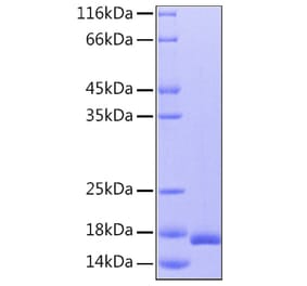 SDS-PAGE - Recombinant Human IL-36RN Protein (C-terminal His Tag) (A330901) - Antibodies.com