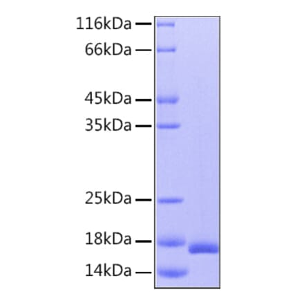 SDS-PAGE - Recombinant Human IL-36RN Protein (C-terminal His Tag) (A330901) - Antibodies.com
