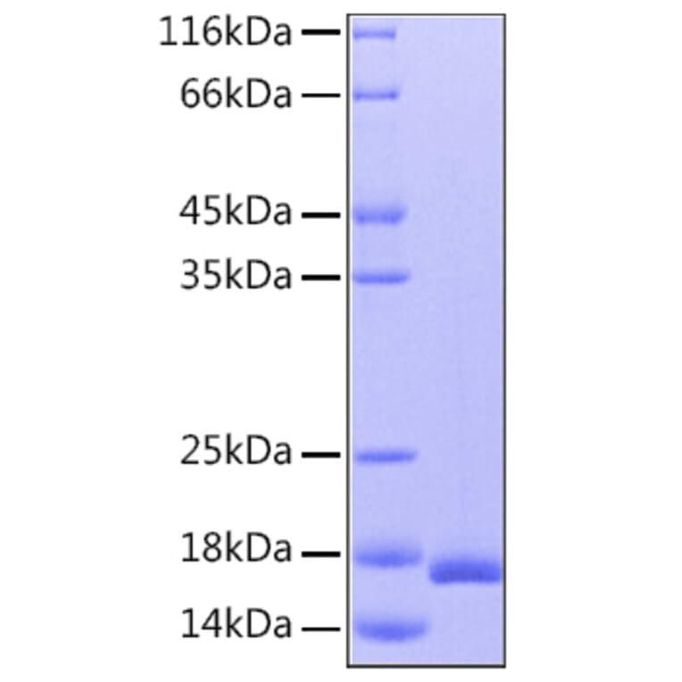 SDS-PAGE - Recombinant Human IL-36RN Protein (C-terminal His Tag) (A330901) - Antibodies.com