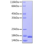 SDS-PAGE - Recombinant Human IL-36RN Protein (C-terminal His Tag) (A330901) - Antibodies.com