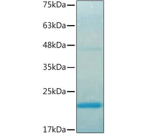 SDS-PAGE - Recombinant Human IL37 Protein (C-terminal His Tag) (A330902) - Antibodies.com