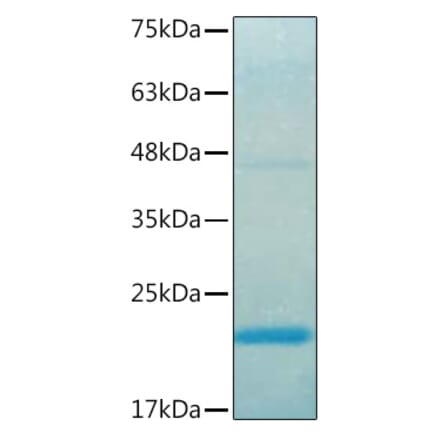 SDS-PAGE - Recombinant Human IL37 Protein (C-terminal His Tag) (A330902) - Antibodies.com
