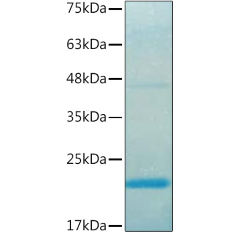 SDS-PAGE - Recombinant Human IL37 Protein (C-terminal His Tag) (A330902) - Antibodies.com