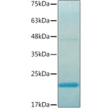 SDS-PAGE - Recombinant Human IL37 Protein (C-terminal His Tag) (A330902) - Antibodies.com