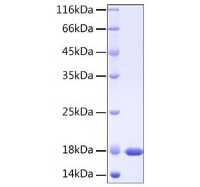 SDS-PAGE - Recombinant Human IL37 Protein (A330903) - Antibodies.com