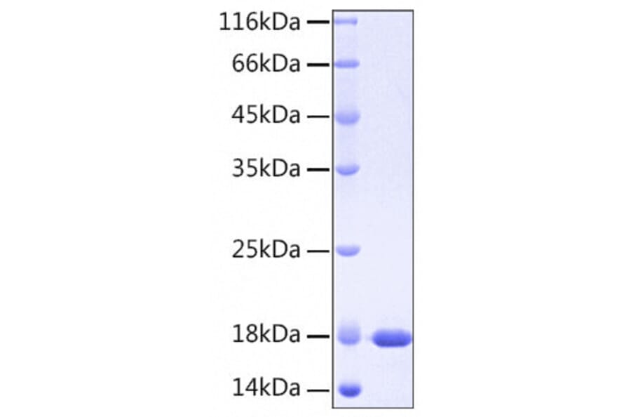 SDS-PAGE - Recombinant Human IL37 Protein (A330903) - Antibodies.com