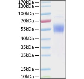 SDS-PAGE - Recombinant Human IL3RA/CD123 Protein (C-terminal His Tag) (A330904) - Antibodies.com